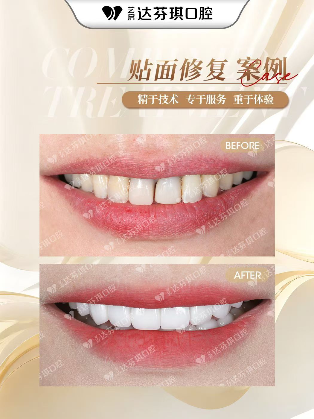 岚山区牙齿矫正公司